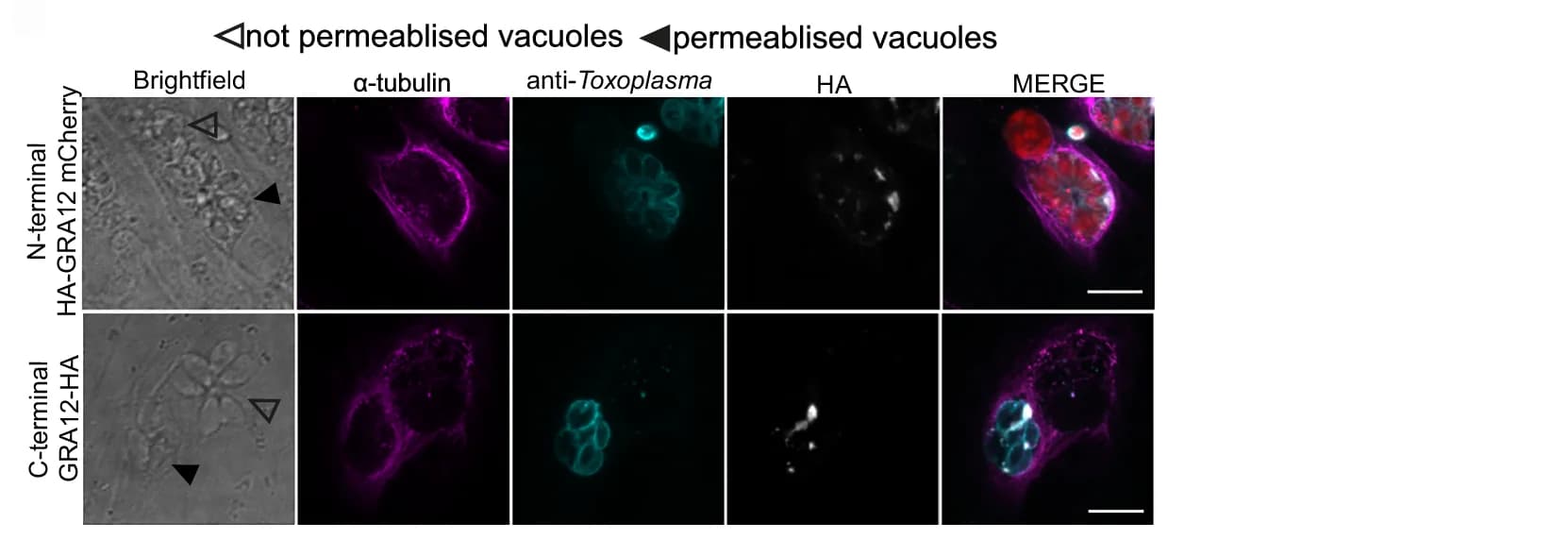 Open access visualization of Microscopy, Immunofluorescence, GRA12, Human Fibroblasts, N-Terminally Tagged Line