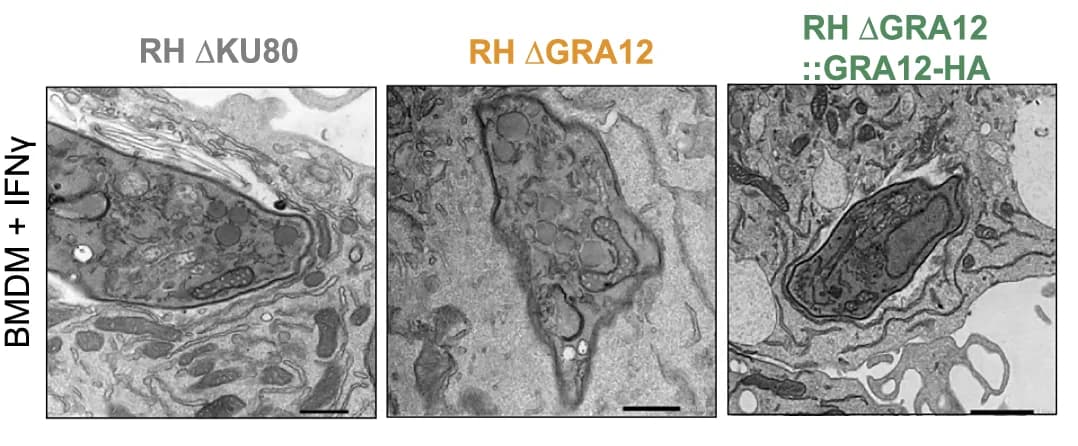 Open access visualization of Microscopy, TEM Images, IFNγ-treated, PWD/PhJ BMDMs, RH ∆KU80
