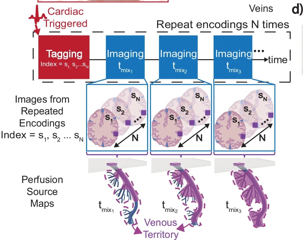 Open access visualization of Workflow, Illustration, Acquisition Strategy, Cardiac Triggering, Labeling