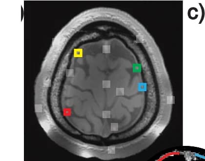 Open access visualization of Microscopy, Vessels, Perfusion Source Map, Image Voxels, Peaks