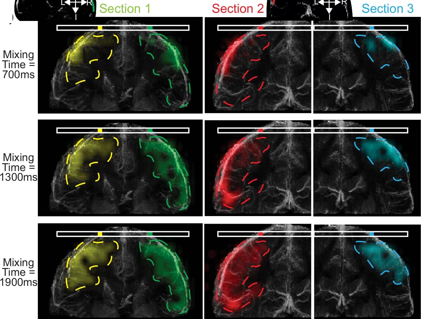 Open access visualization of Microscopy, Photo, 2D Perfusion Maps, ROIs, QSM Venograms