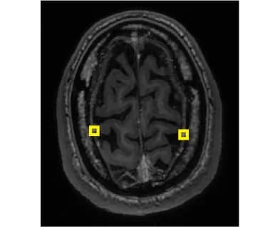 Open access visualization of Photo, Vein ROIs, Image