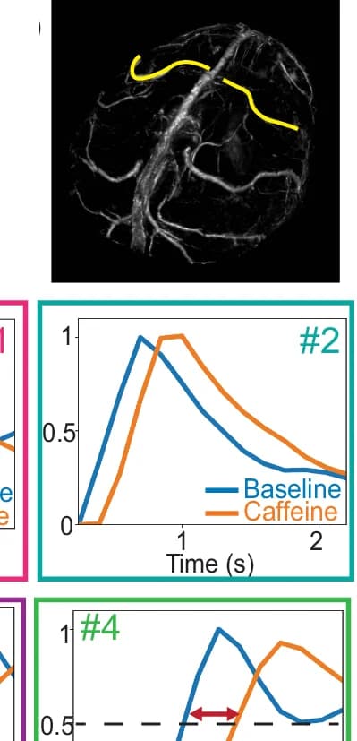 Open access visualization of Line Plot, Microscopy, Veins, 3D venogram