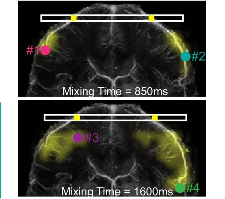Open access visualization of Microscopy, Perfusion Source Maps, Veins, Mixing Times