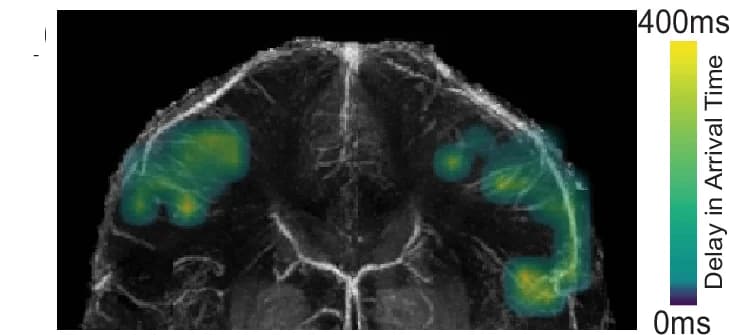 Open access visualization of Microscopy, Arrival Time Delay, Perfusion Source Maps