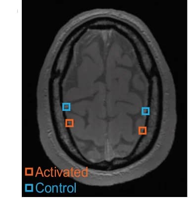 Open access visualization of Microscopy, Imaging, Veins, Motor Cortices, Control