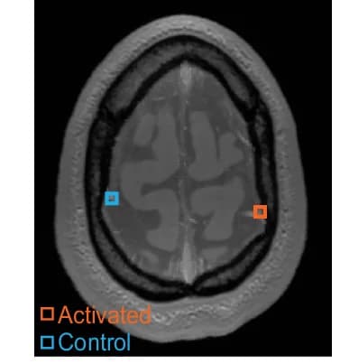 Open access visualization of Microscopy, Veins, Motor Cortex, Control