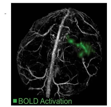 Open access visualization of Microscopy, Blood Oxygenation Level Dependent, Activations, Venogram