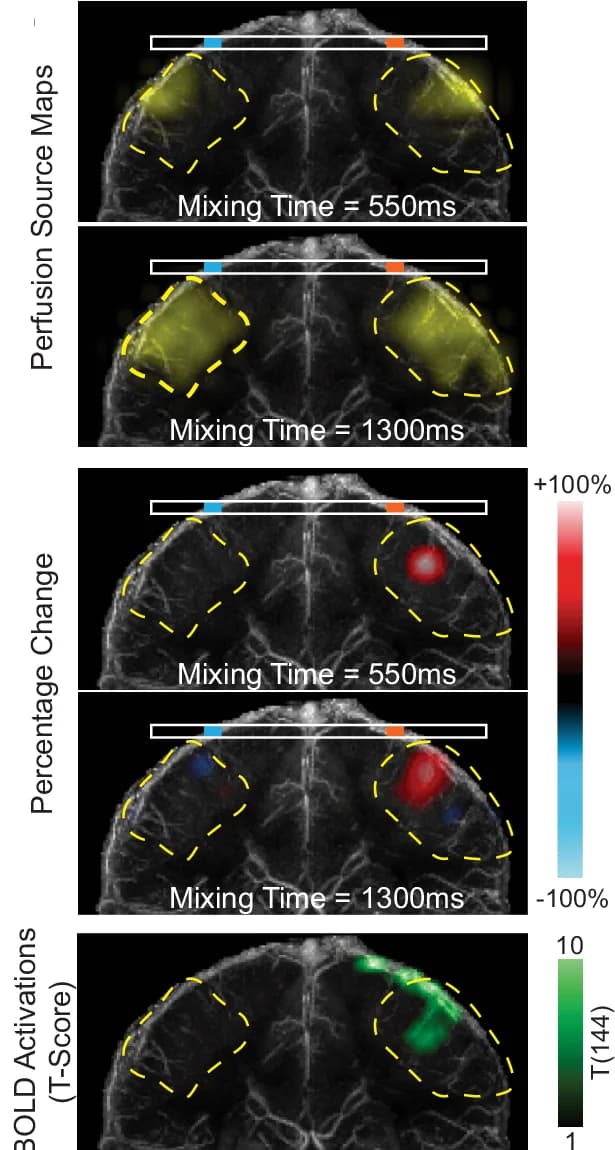Open access visualization of Microscopy, Perfusion, Veins, Blood Oxygenation Level Dependent, T-Scores