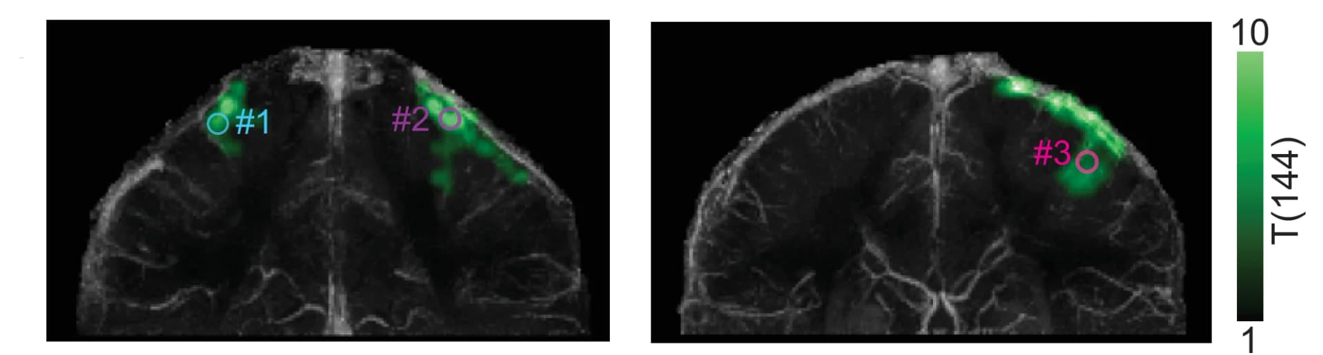 Open access visualization of Heatmap, Microscopy, Blood Oxygenation Level Dependent, BOLD, T-scores