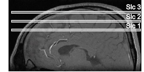 Open access visualization of Photo, Sagittal Slice, Axial Imaging Slices