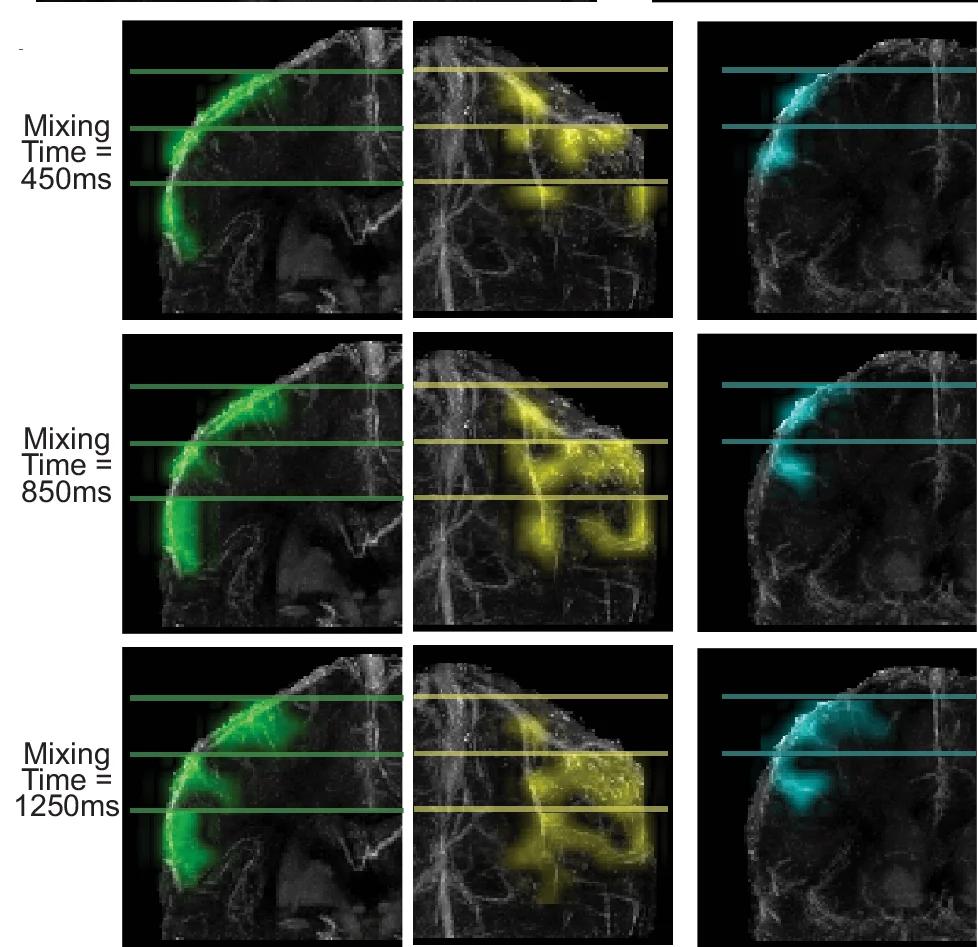 Open access visualization of Microscopy, Superior Vein, QSM-Venogram, Perfusion Source Maps, Imaging Slices