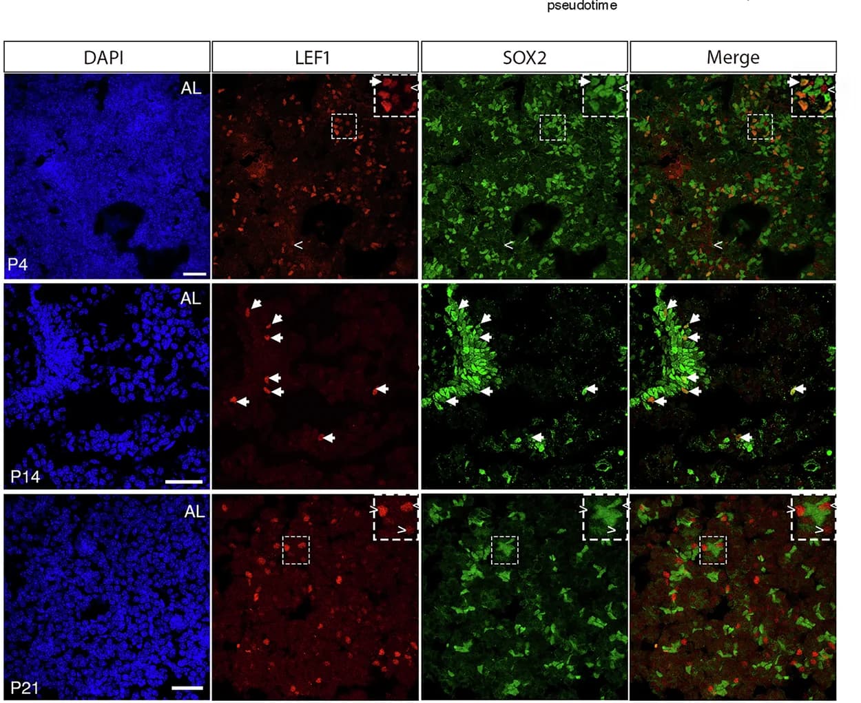 Open access visualization of Microscopy, Immunostaining, LEF1, SOX2, Male Pituitaries