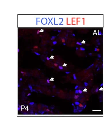 Open access visualization of Microscopy, LEF1, FOXL2, POU1F1, Progenitors