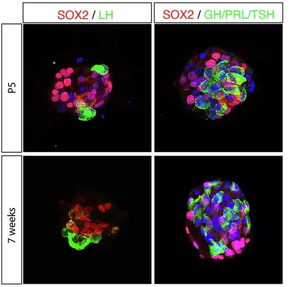 Open access visualization of Microscopy, Pituispheres, Pituitary, Immunofluorescence, Differentiated Cells