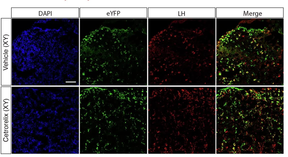 Open access visualization of Microscopy, Immunofluorescence, eYFP, LH, Pituitary