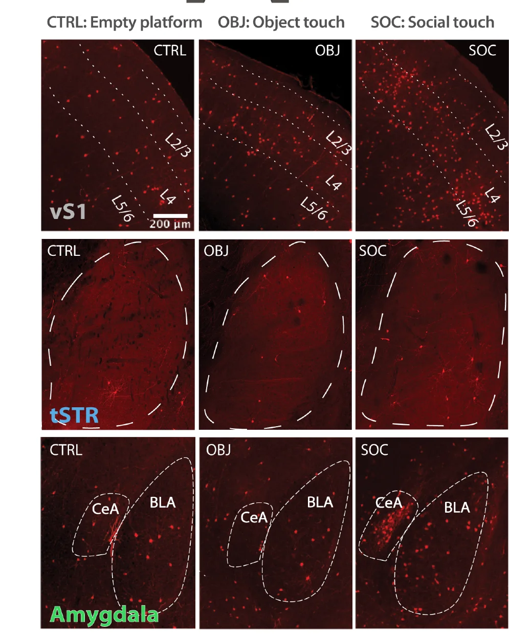 Open access visualization of Microscopy, cFos Expression, vS1, tSTR, Central Amygdala
