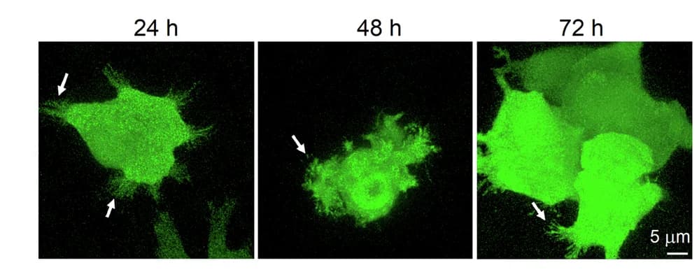 Open access visualization of Microscopy, Fluorescence Micrographs, HeLa Cells, SaBeH Gels, Filopodia