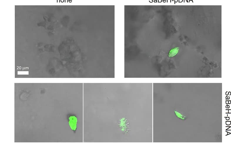 Open access visualization of Microscopy, Fluorescence Micrographs, HeLa Cells, SaBeH Gels, pDNA