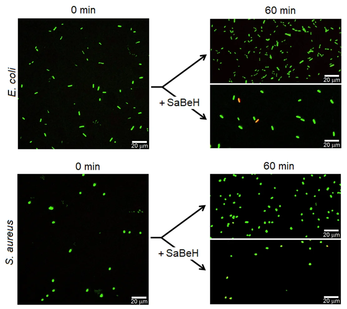 Open access visualization of Microscopy, Fluorescence Micrographs, Escherichia coli, Staphylococcus aureus, SaBeH