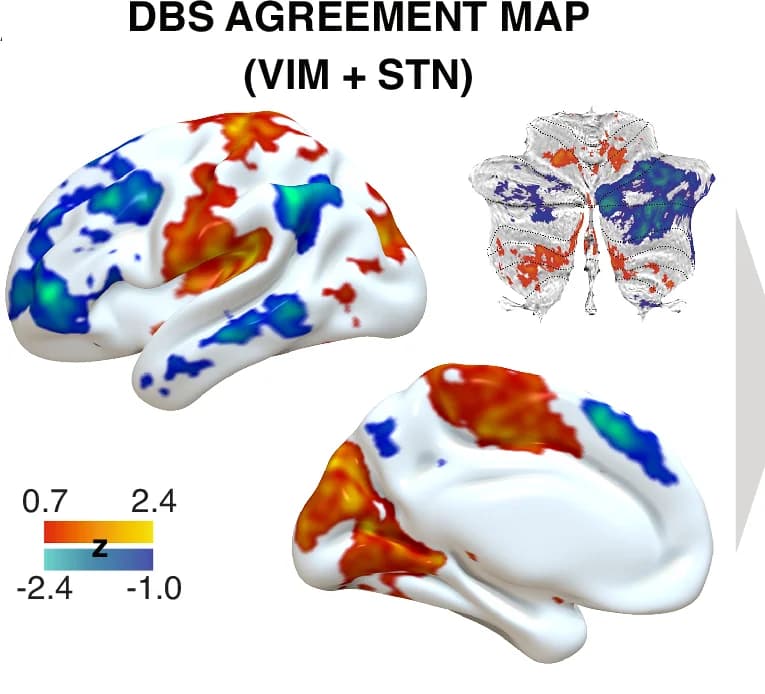 Open access visualization of 3D Plot, Protein Structure, Agreement Map, STN Cohort, VIM Cohort