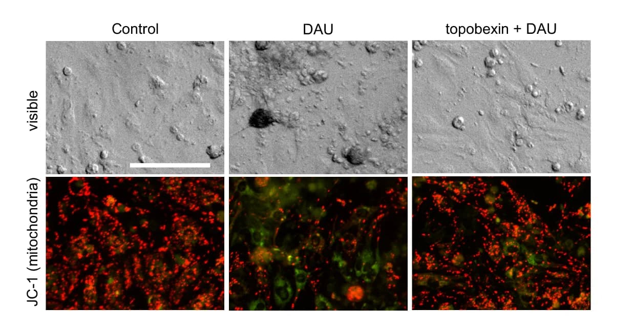 Open access visualization of Microscopy, Live-Cell Imaging, NVCM Cells, Cytotoxicity, DIC Mode