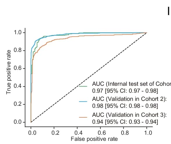 Open access visualization of Line Plot, Receiver Operating Characteristic Curves, Model Performance, Hold-Out Test Set, Discovery Cohort
