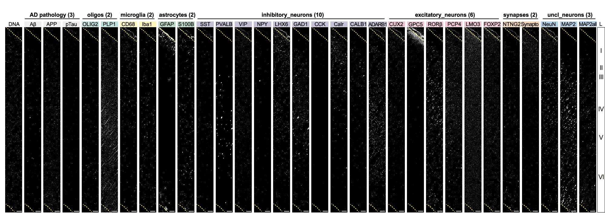 Open access visualization of Microscopy, IMC Images, Region Of Interest, Antibody Panel, Neocortex Cortex