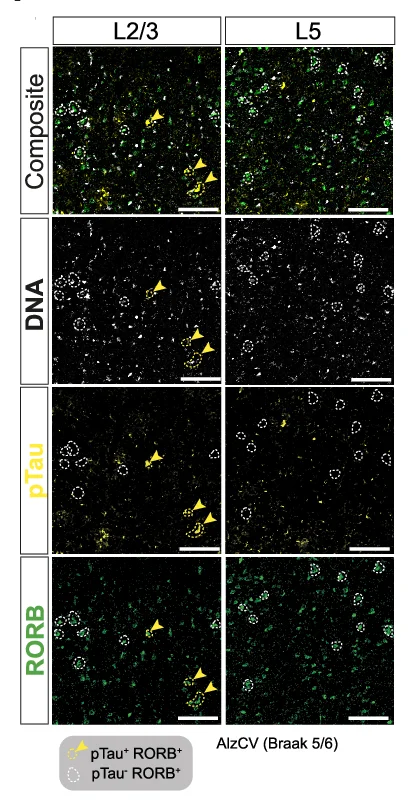 Open access visualization of Microscopy, RORB, AT8, pTau, AlzCV
