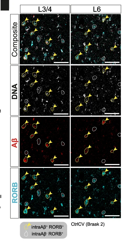 Open access visualization of Microscopy, RORB, 4G8, Aβ, CtrlCV