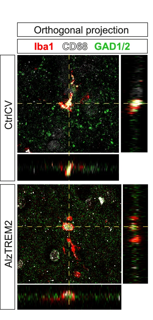 Open access visualization of Microscopy, Orthogonal Projection, Immunostaining, Iba1, GAD1