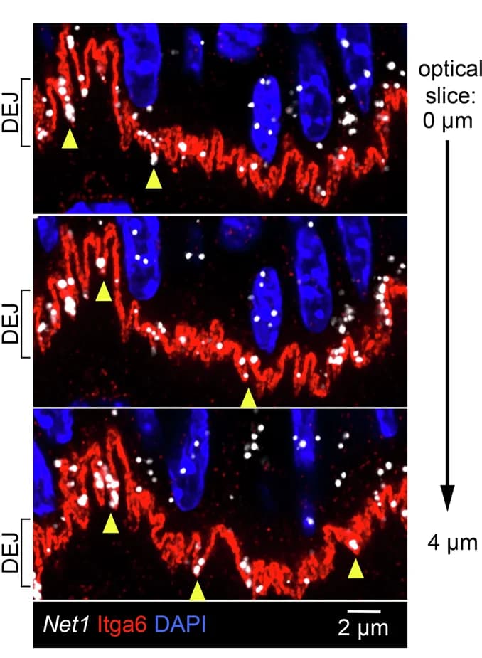 Open access visualization of Microscopy, Mouse Tongue, Net1 mRNA, DEJ, Basal Keratinocyte