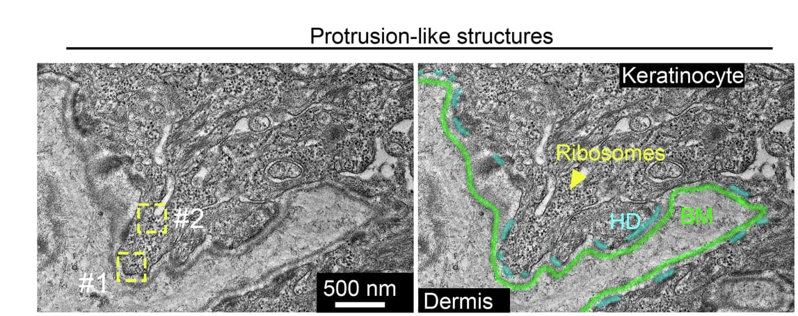 Open access visualization of Microscopy, Transmission Electron Micrograph, Keratinocyte, Protrusion-like Structure, Mouse Tongue