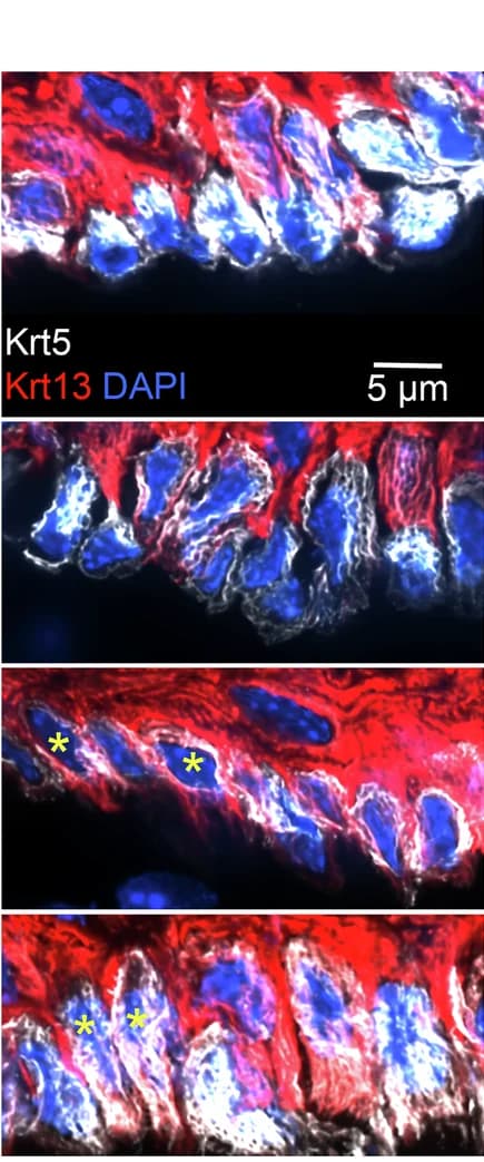 Open access visualization of Microscopy, Basal Keratinocytes, Spinous Keratinocytes, Tongue Epithelium, Krt5