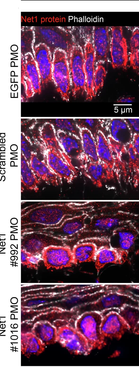 Open access visualization of Microscopy, Net1 Protein, Phalloidin, Cell Cortex, PMO-treated Tissues