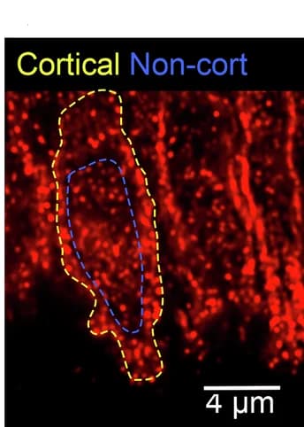 Open access visualization of Microscopy, Net1 Protein, Cell Cortex, Non-cortical Region