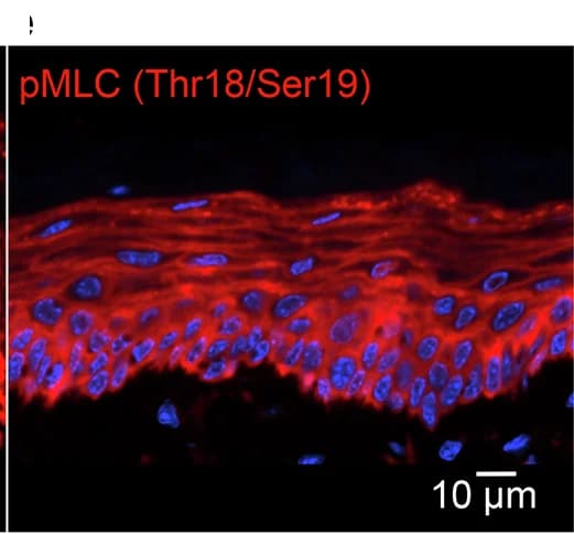 Open access visualization of Microscopy, MLC2 Phosphorylation, pMLC, PMO-treated, Mouse Epithelium