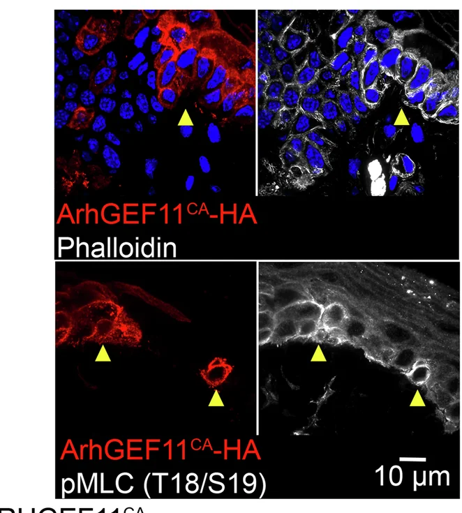 Open access visualization of Microscopy, Actin Cytoskeleton, Phalloidin, pMLC, ArhGEF11 CA-HA