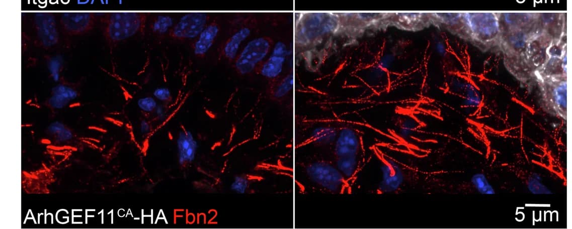 Open access visualization of Microscopy, HA, Fbn2, DEJ, WT Mice