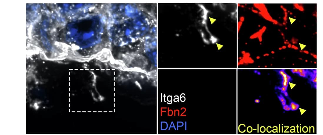 Open access visualization of Microscopy, ArhGEF11 CA, Plasma Membrane, DEJ, RhoA Activation