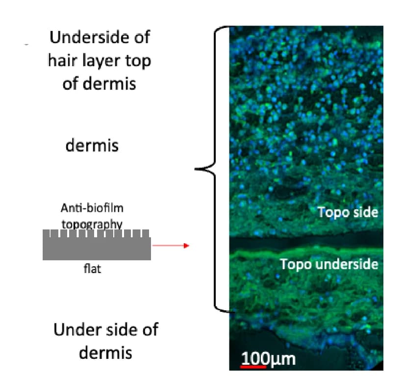 Open access visualization of Microscopy, Illustration, Explant, Host Cell Migration, TopoUnit
