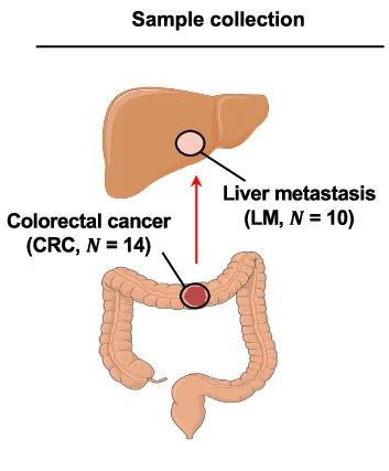 Open access visualization of Illustration, Workflow, Primary CRC, LM Slices