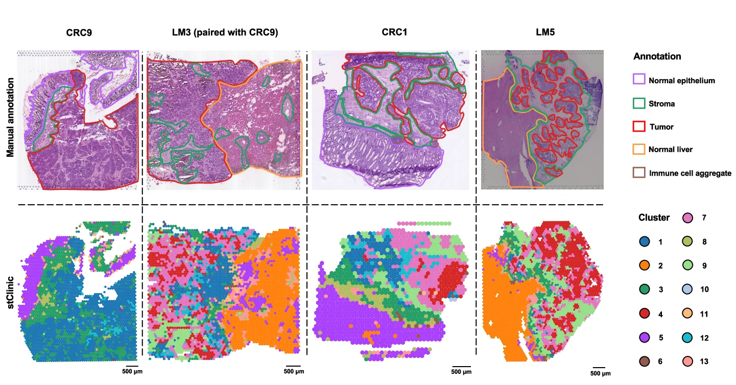 Open access visualization of Microscopy, Scatter Plot, H&E Plot, Slices, Pathological Annotations