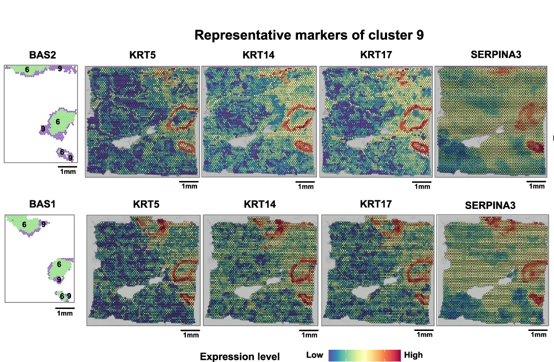 Open access visualization of Heatmap, Spatial Distribution, Cluster 9, Marker Genes, KRT5