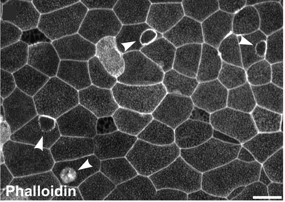 Open access visualization of Microscopy, Actin Ruffles, Epidermis, Xenopus Embryo, Phalloidin