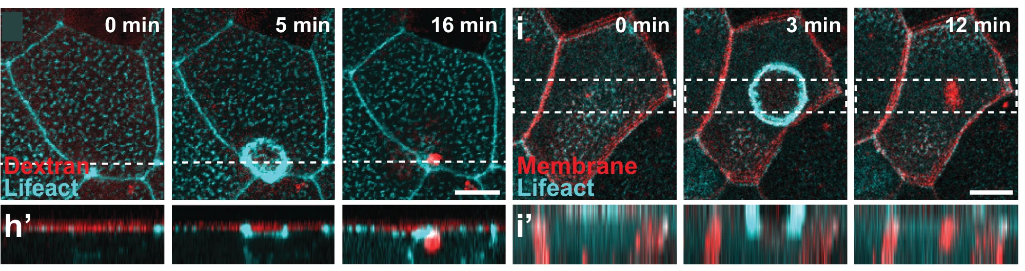 Open access visualization of Microscopy, Time Lapse Image, Lifeact-FP, Macropinocytotic Internalization, Fluorescent Dextran