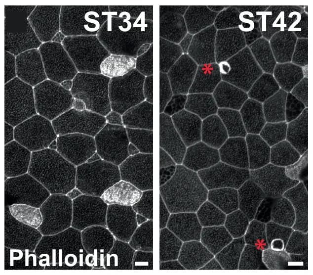 Open access visualization of Microscopy, Xenopus, Phalloidin, Actin Ruffles