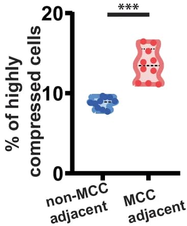 Open access visualization of Violin Plot, Scatter Plot, Percentage, Effective Pressure, Multiciliated Cells