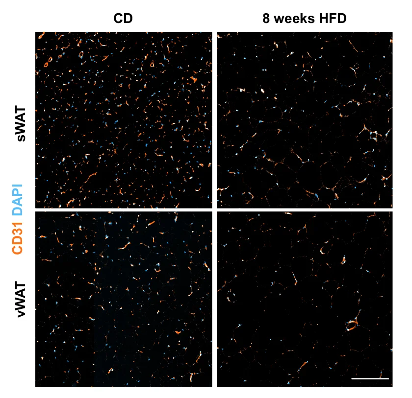 Open access visualization of Microscopy, Confocal Images, CD31+ Blood Vessels, DAPI+ Nuclei, Subcutaneous White Adipose Tissue