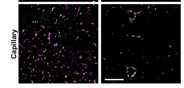 Open access visualization of Microscopy, Capillary Beds, Lean Mice, Obese Mice, Control Diet